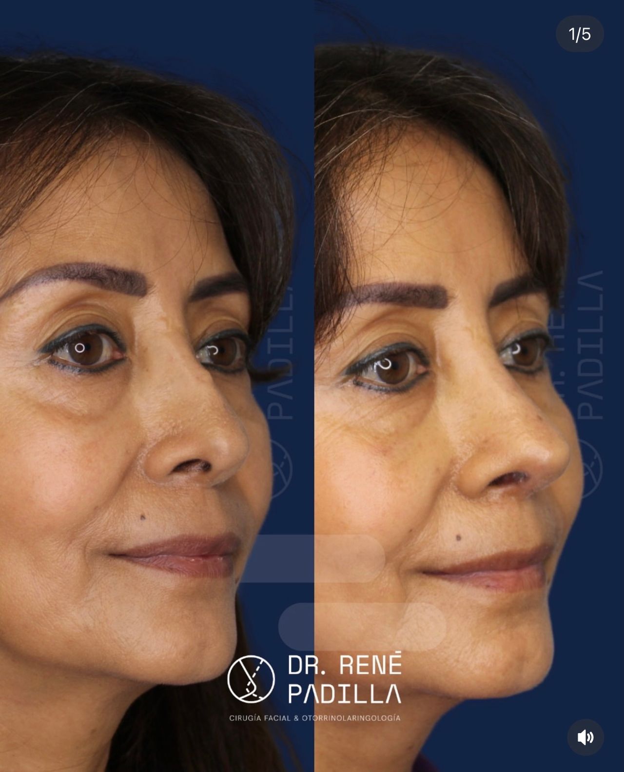 René Emmanuel Padilla López-12