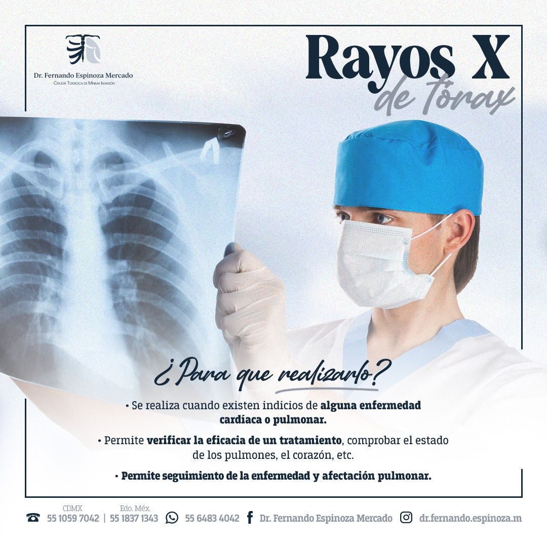 Fernando Espinoza Mercado-18