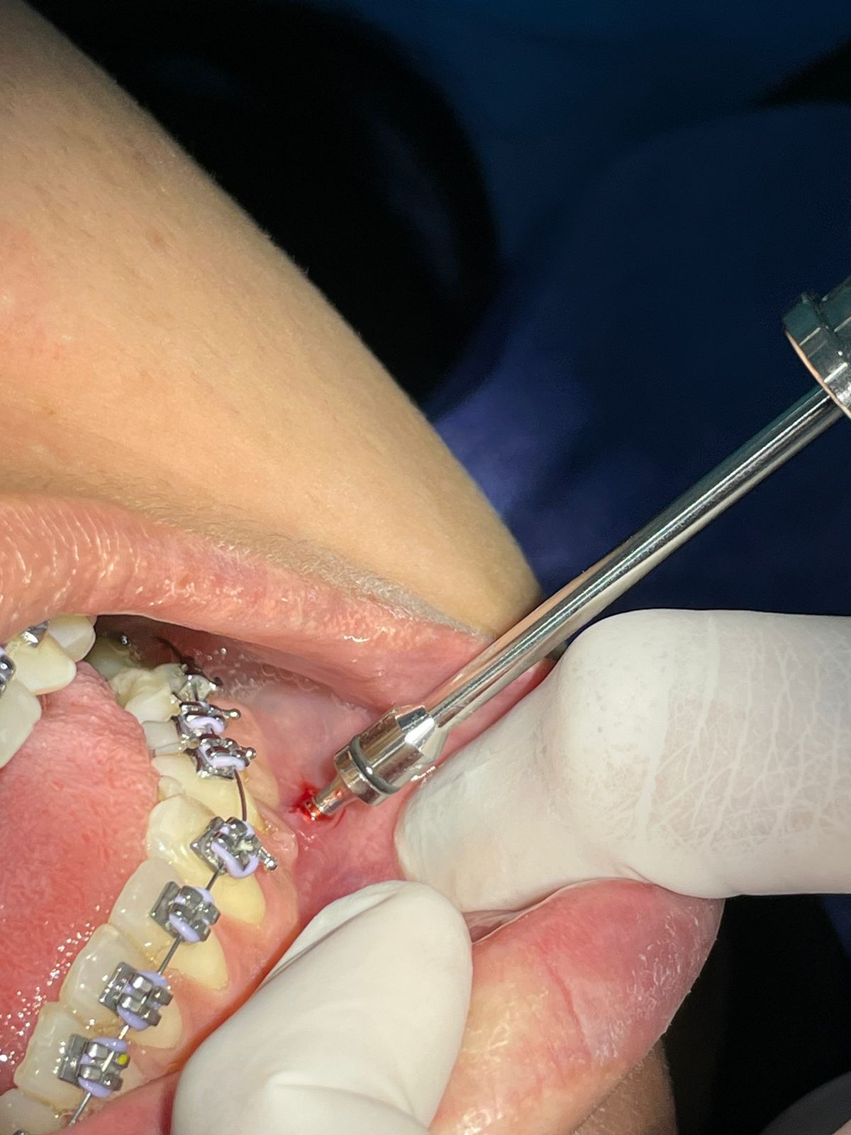 Neydith Martínez Pablo-3