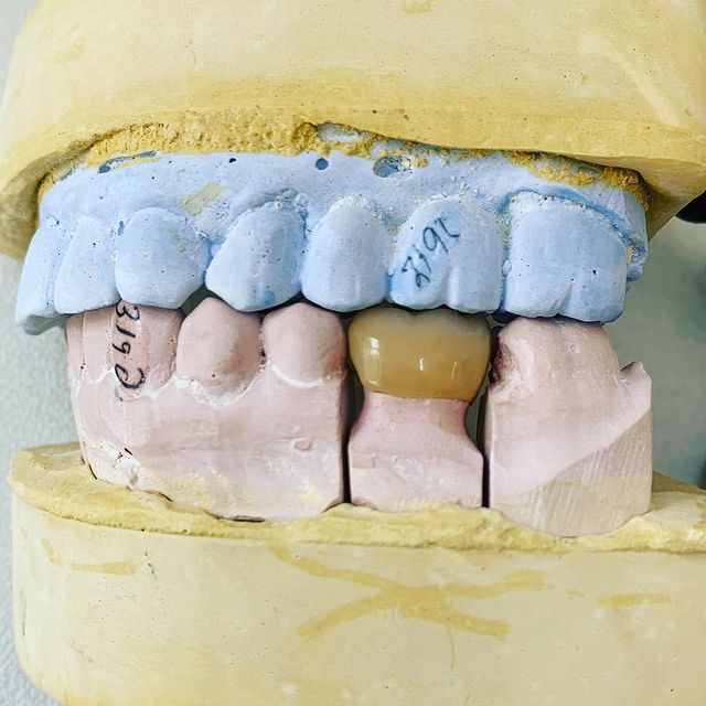 Alejandro Angelo López Díaz-14