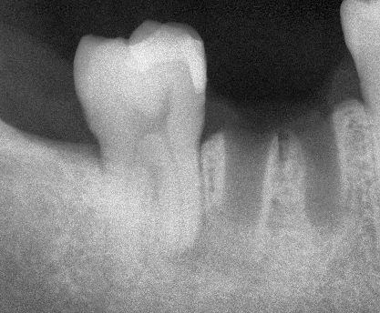 Ivan Torres Rascon-9