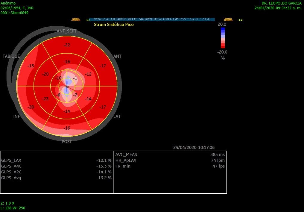 Leopoldo Garcia Lamas-1