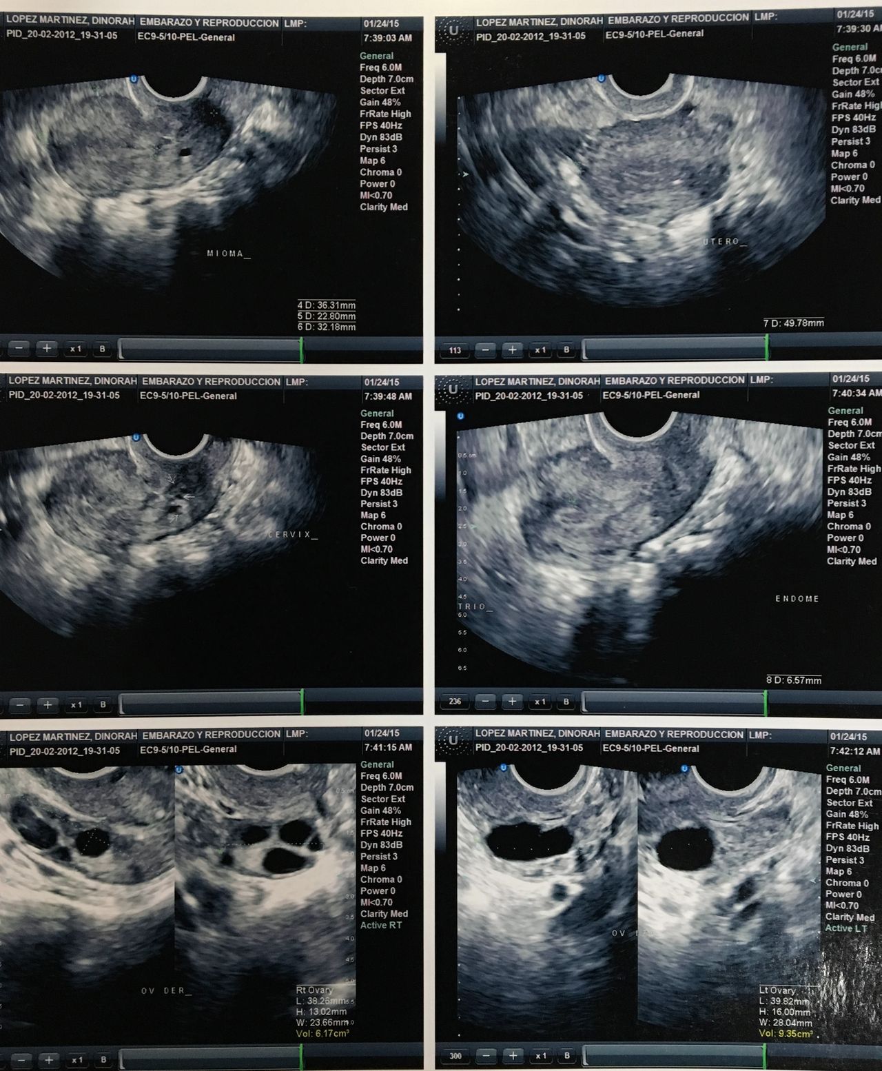 Mayi Mayret Mesquiti-25