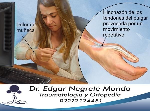 Edgar Negrete Mundo-1