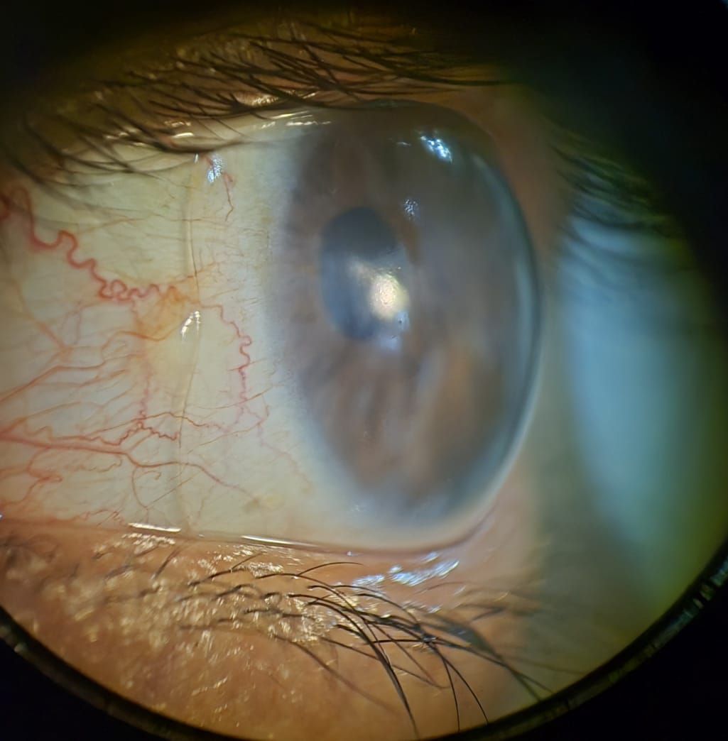 Omar Flores Cárdenas-17