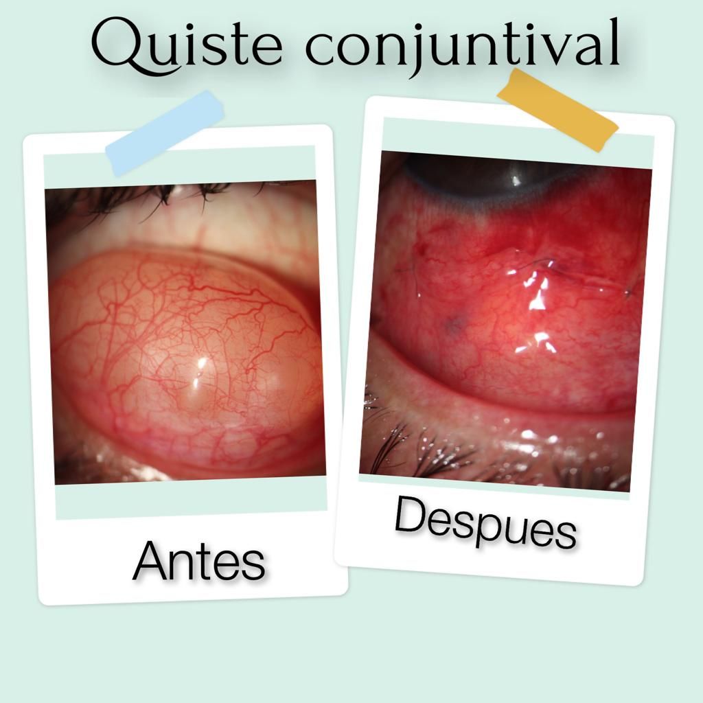 Jorge Ozorno Zárate-1