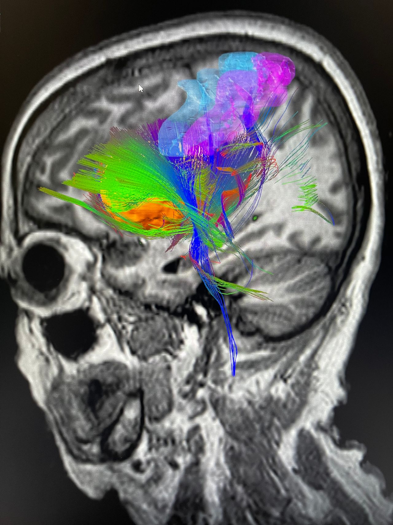 Juan Antonio Alvaro Heredia-4