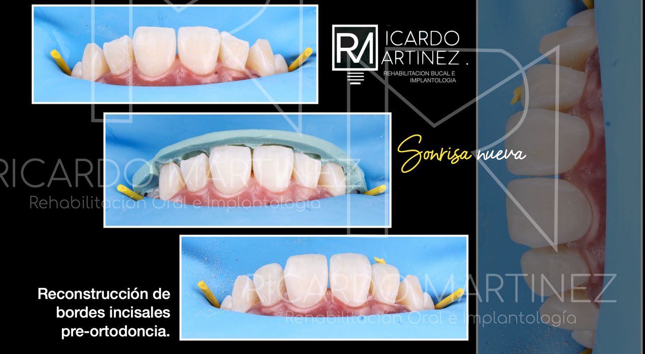 J. Ricardo Martínez-17