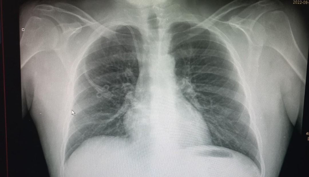 Gonzalo Anuar Montalvo Dominguez-4