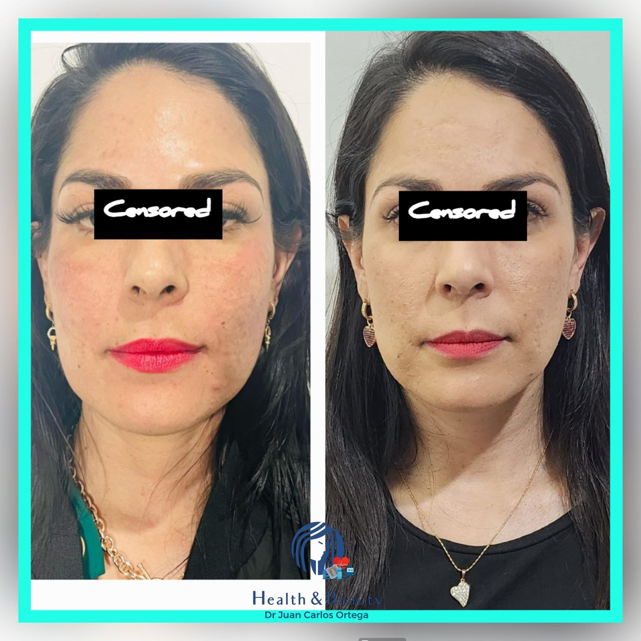 Juan Carlos Ortega Regalado-8