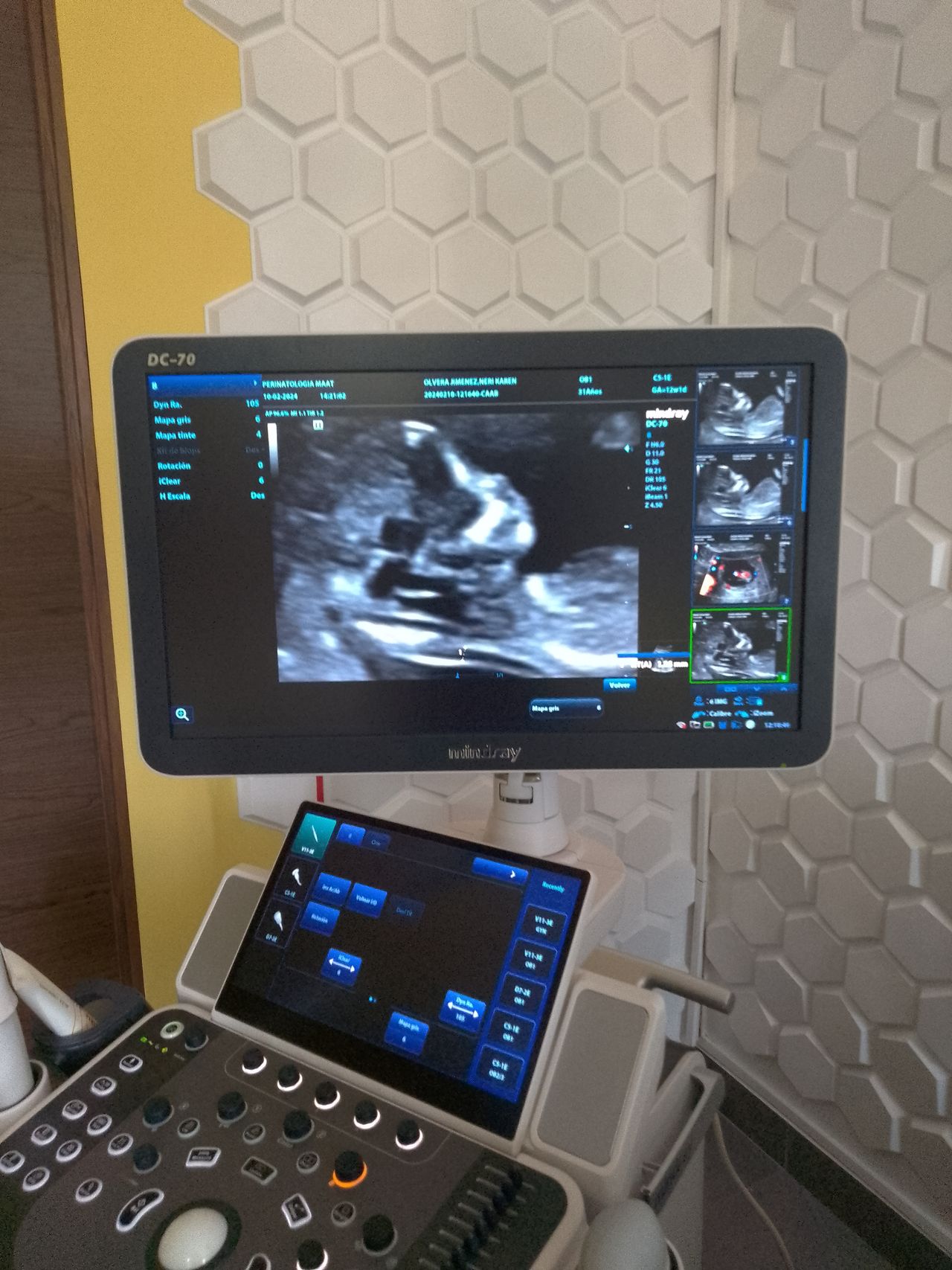 Carlos Gabriel Briones Vega-5