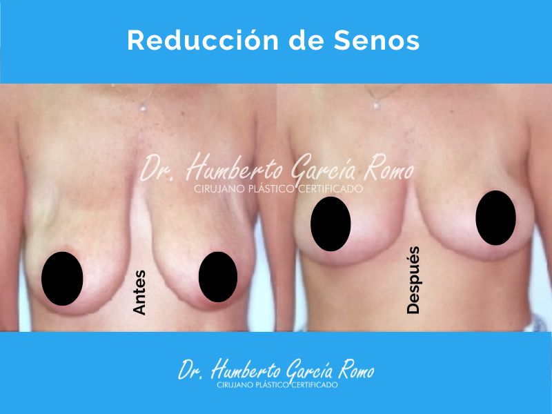 Humberto García Romo-4