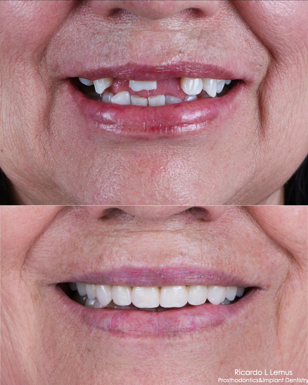 Ricardo López Lemus-94