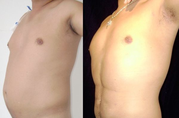 Edgar Ernesto Torres Mejía-8