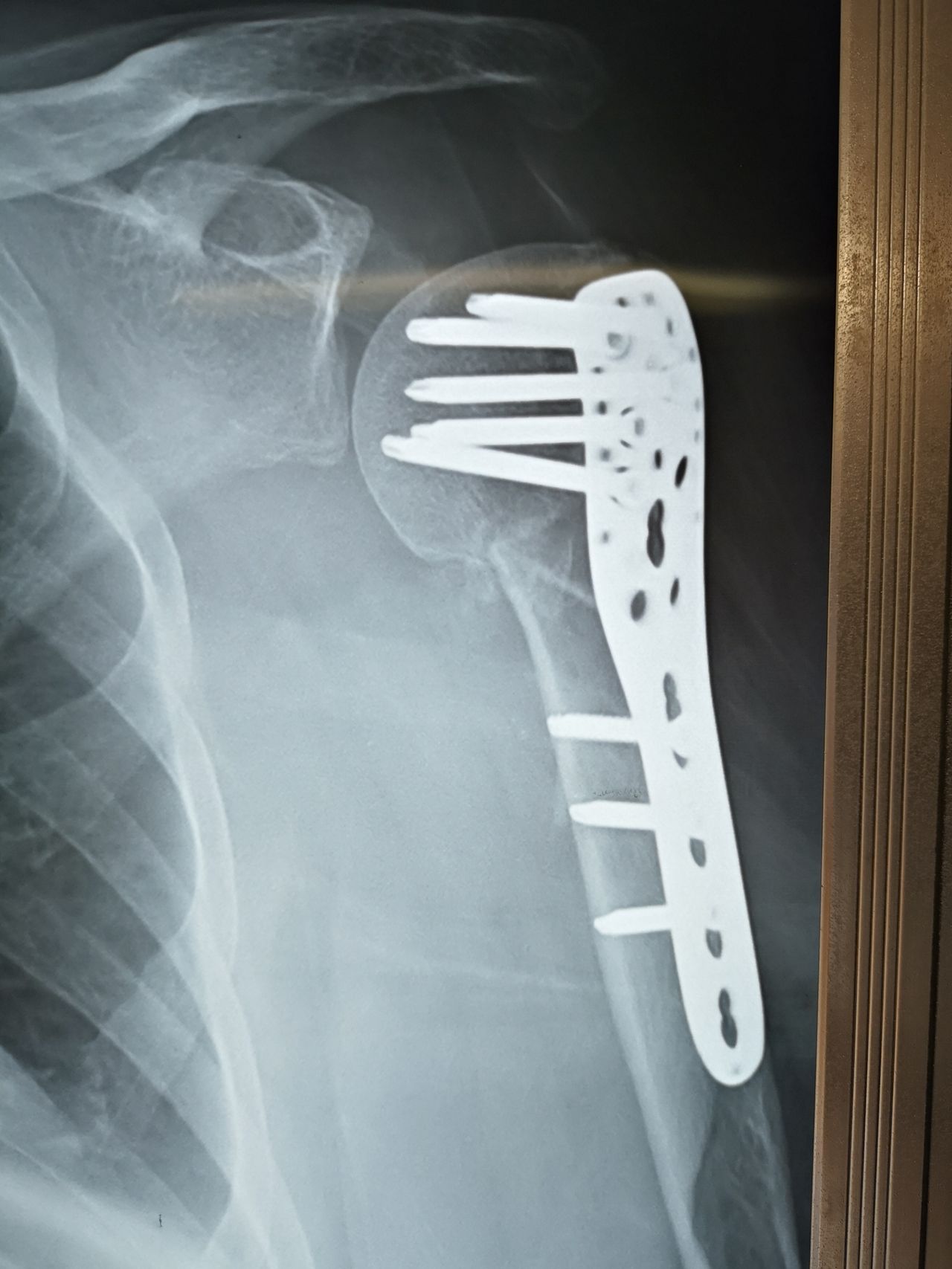 Manuel Ernesto Palma Palma-6