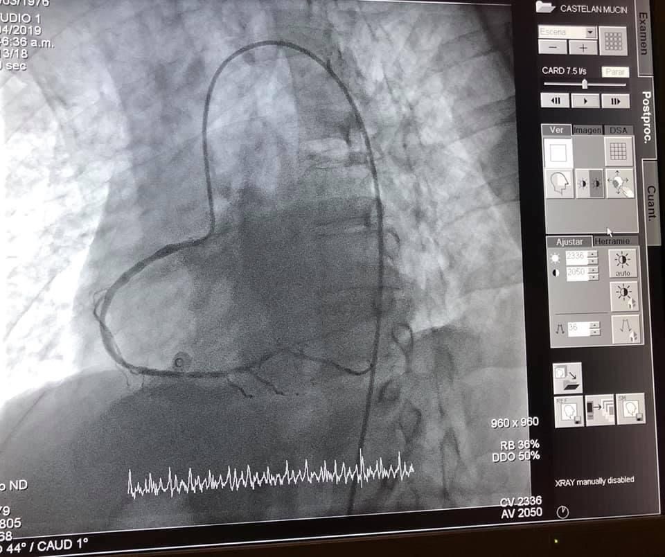 Luis Guillermo Burelo Lopez-8