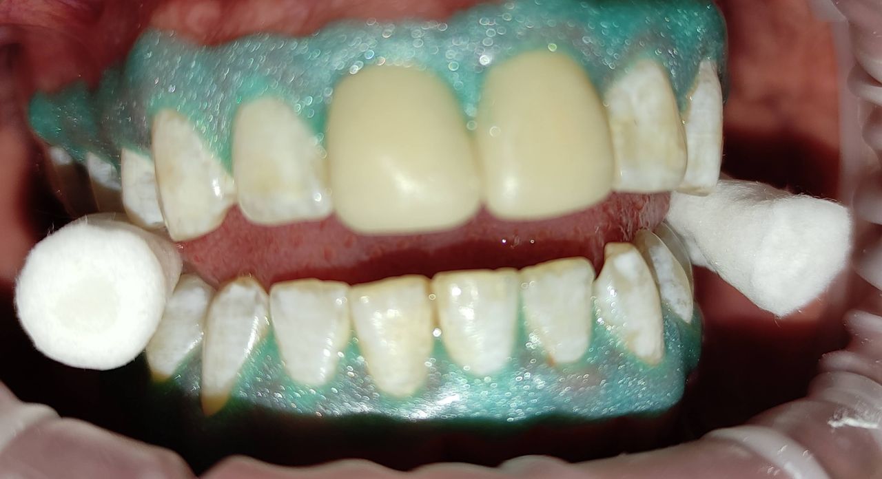 Yaneth Gutiérrez Sánchez-25