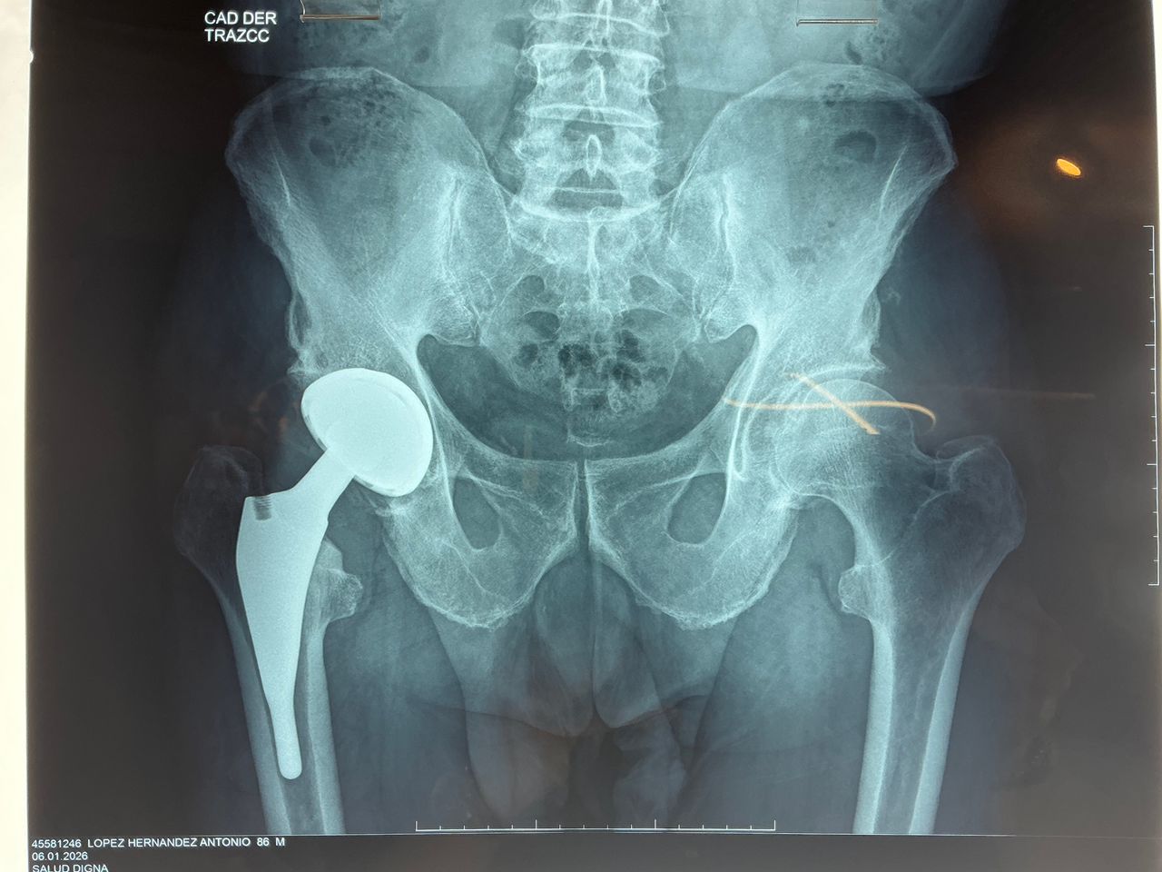 Alejandro Martínez Ramírez-31