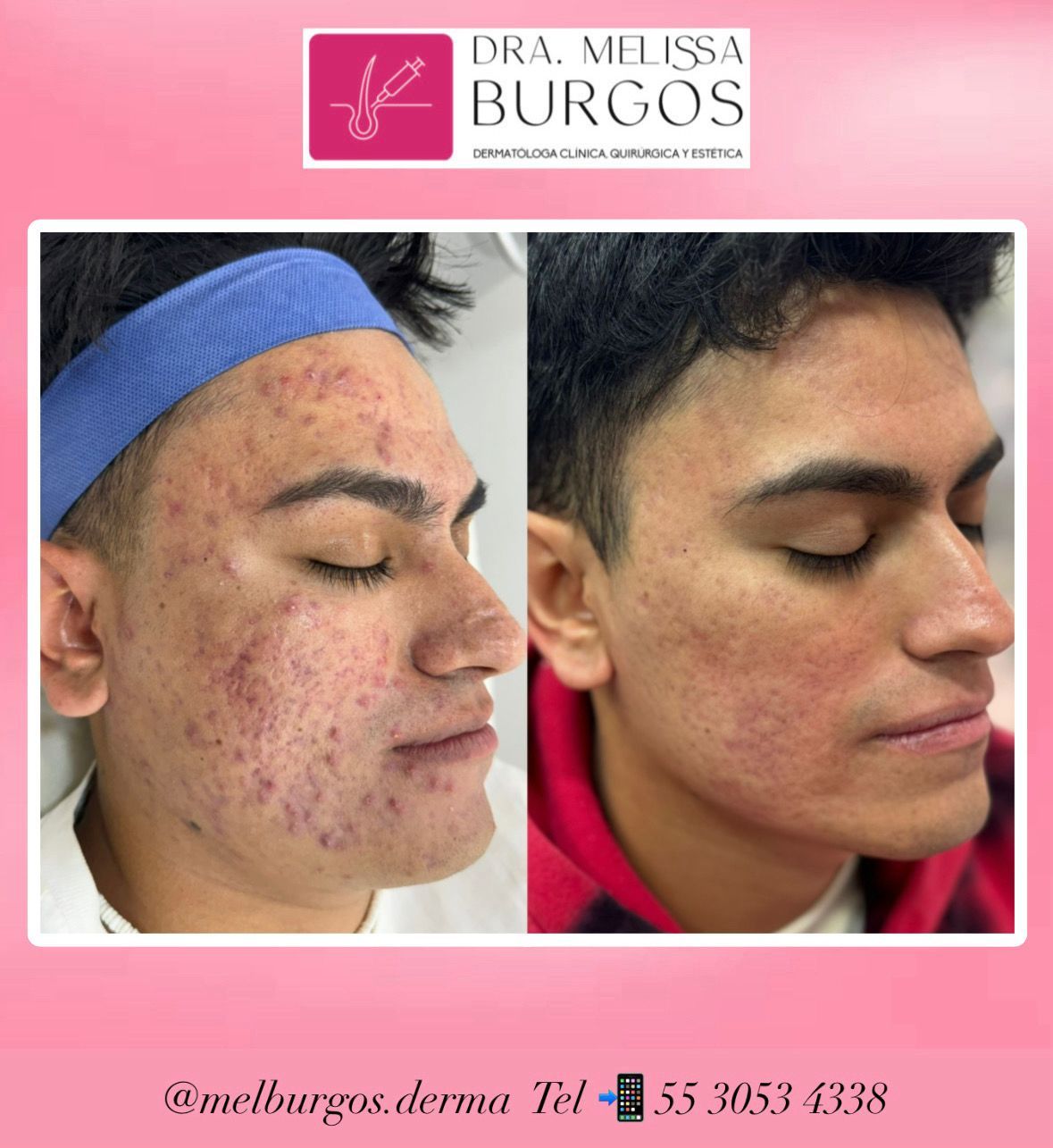 Melissa Burgos Romero-6