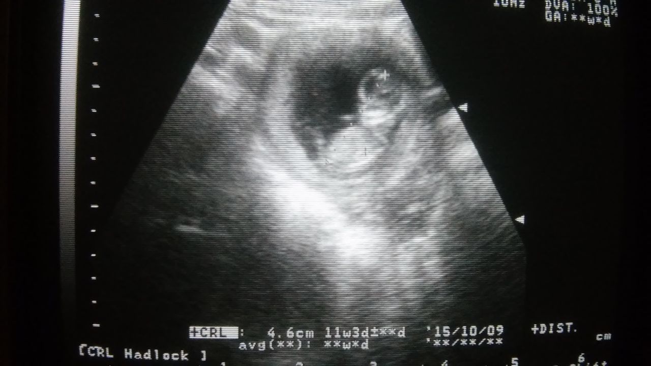 Andrés Vicente Vela Vizuet-33