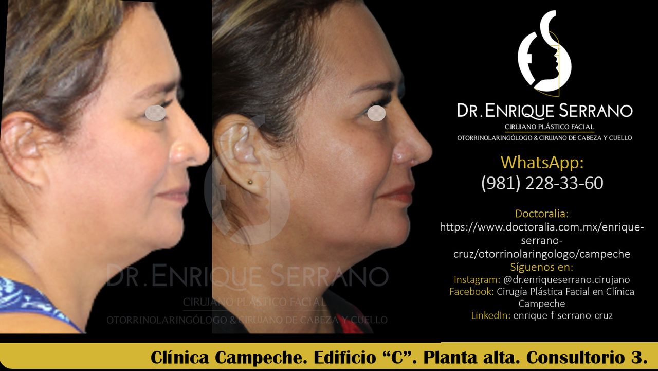 Enrique Serrano Cruz-57