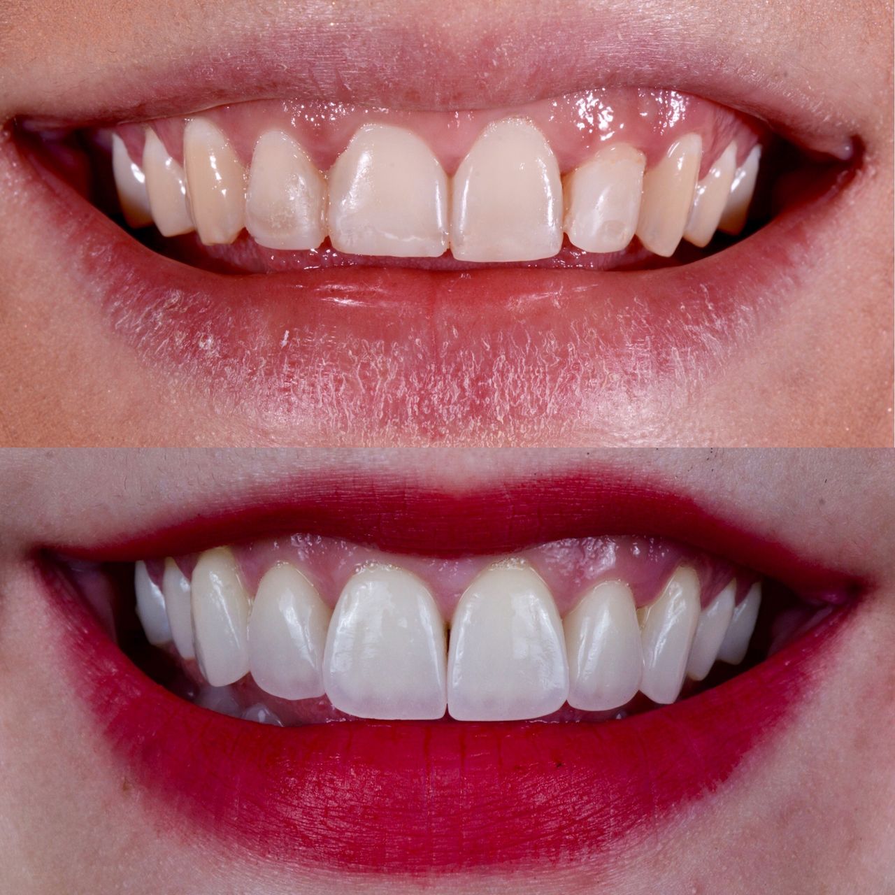 Mauricio Villegas Akena-17