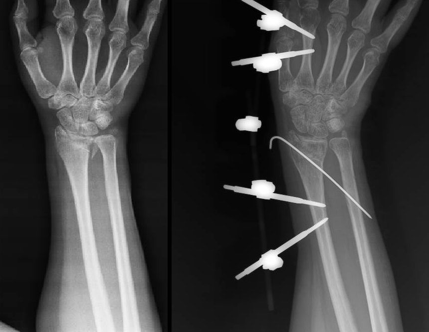 Luis Castañón Robles-21