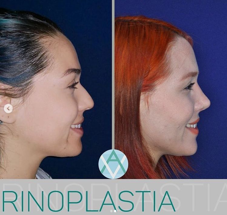 Alfonso Villaseñor Herrero-9