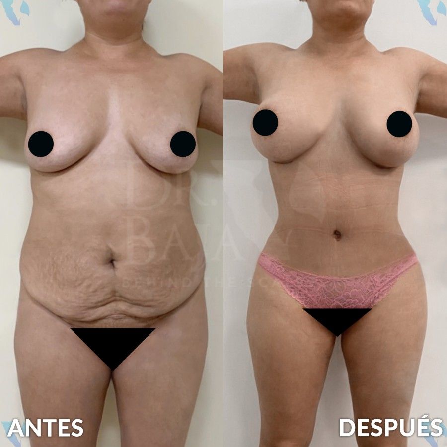 Renato Rodríguez Hirales-18