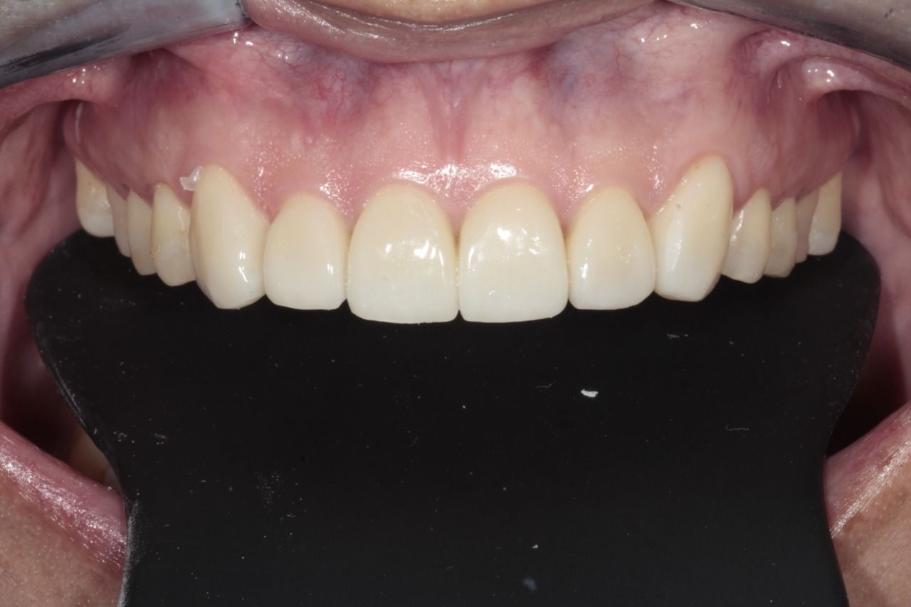 Mariel Itzayani Torres López-21