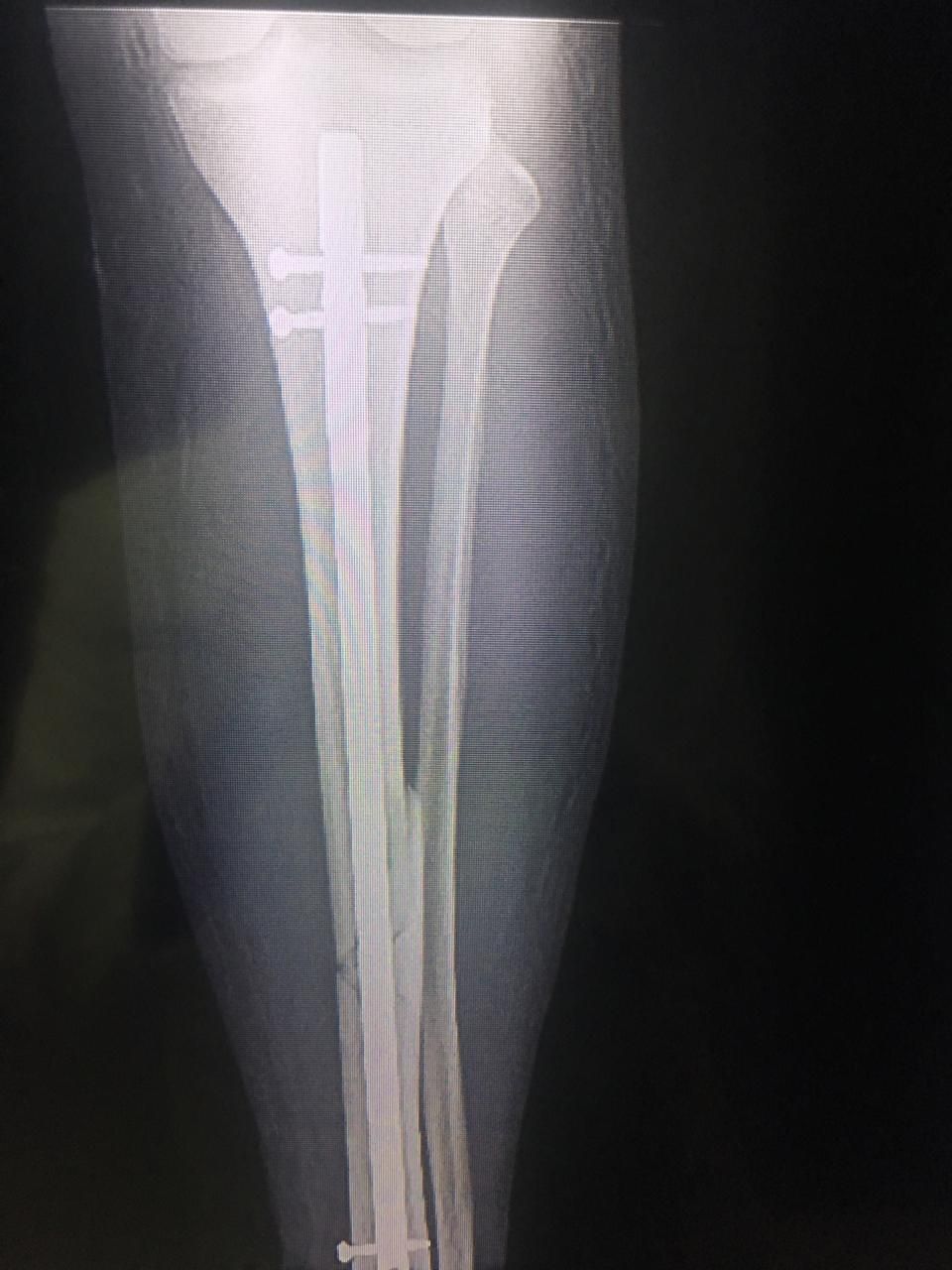 Ricardo Rivas Meléndez-17