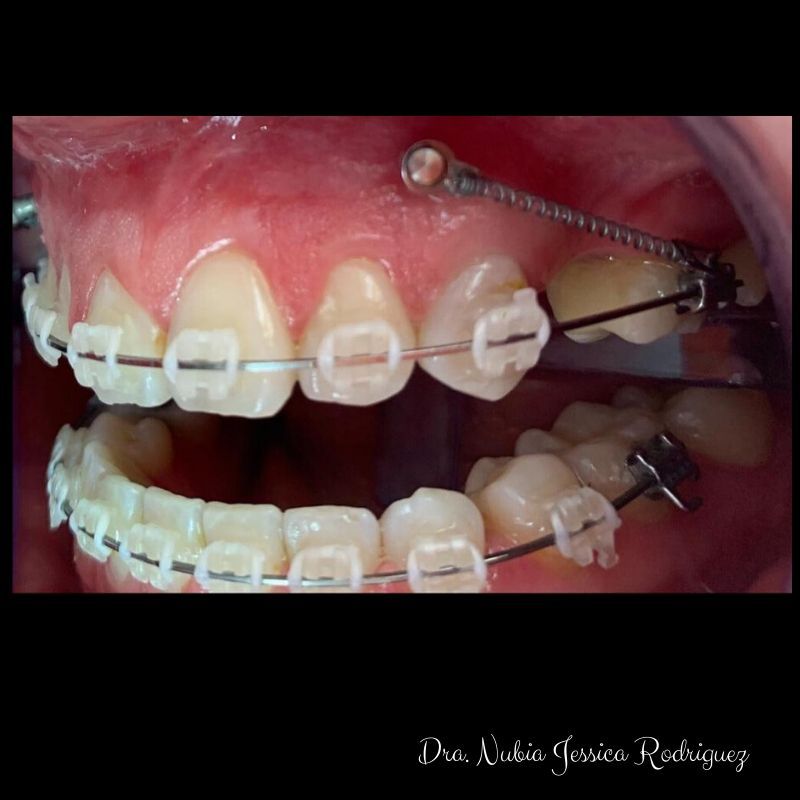 Nubia Jessica Rodríguez  Gutiérrez-23