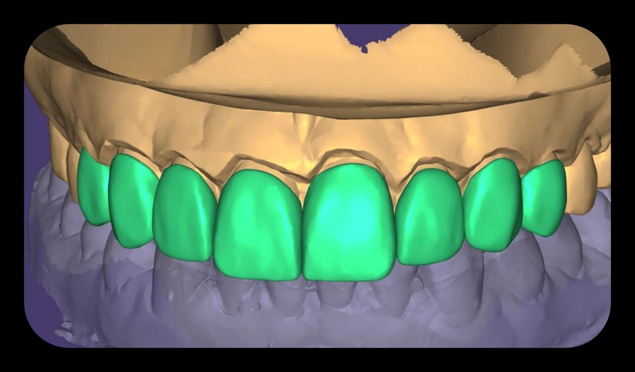 Edgardo Caballero Dávila-28