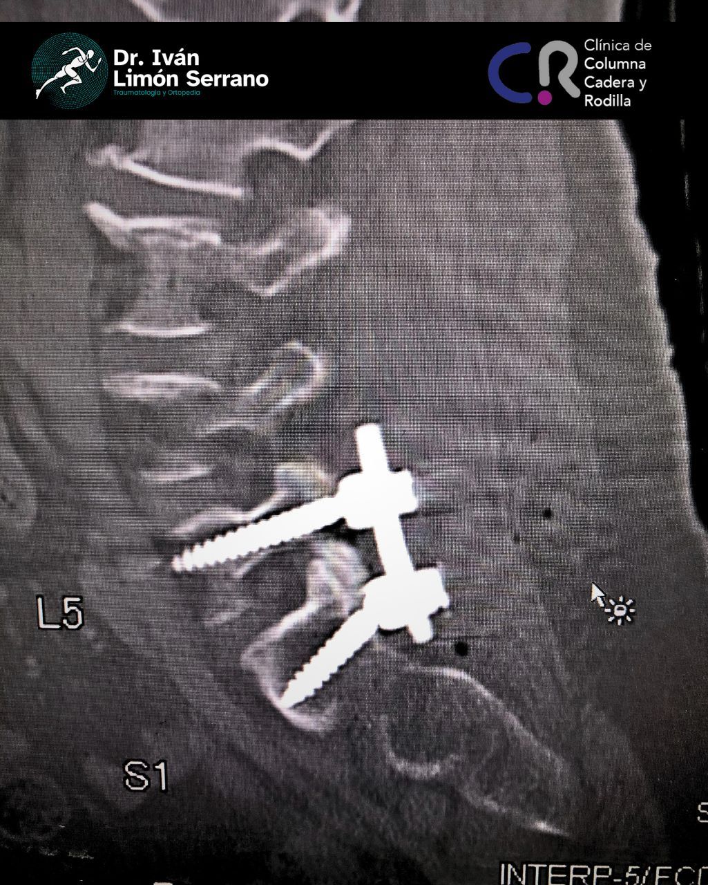 Iván Limón Serrano-30
