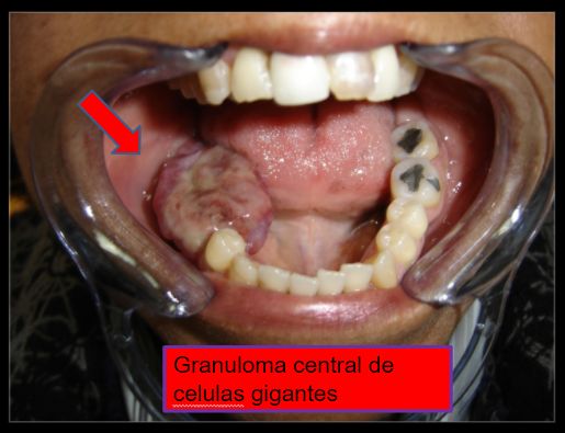 Diana Araceli Dávila Hernández-15