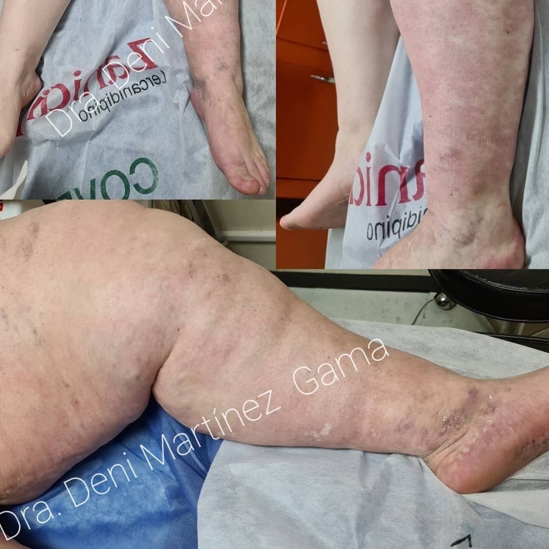 Deni Martínez Gama-11