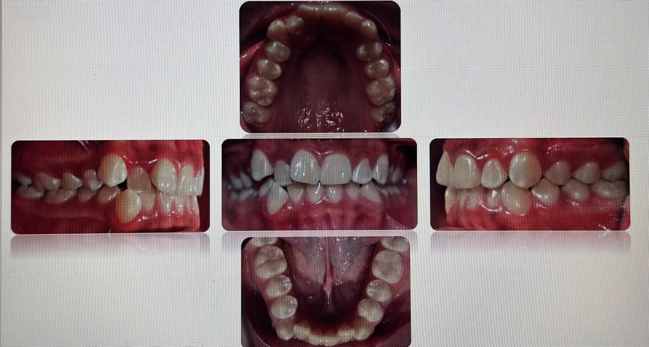 Antonio Gomez Arenas-14