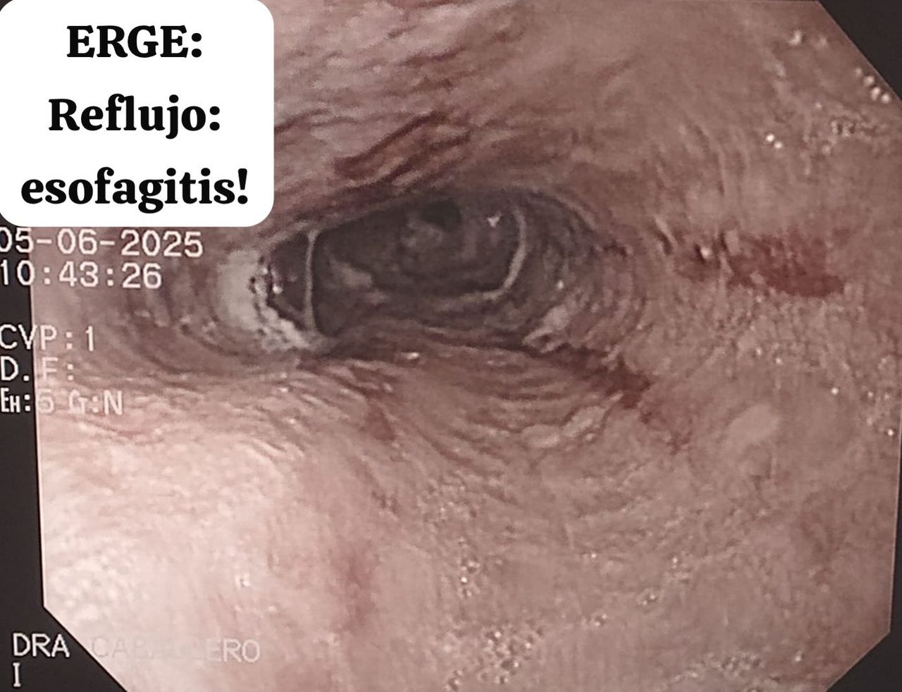 Priscilla Caballero Vázquez-7