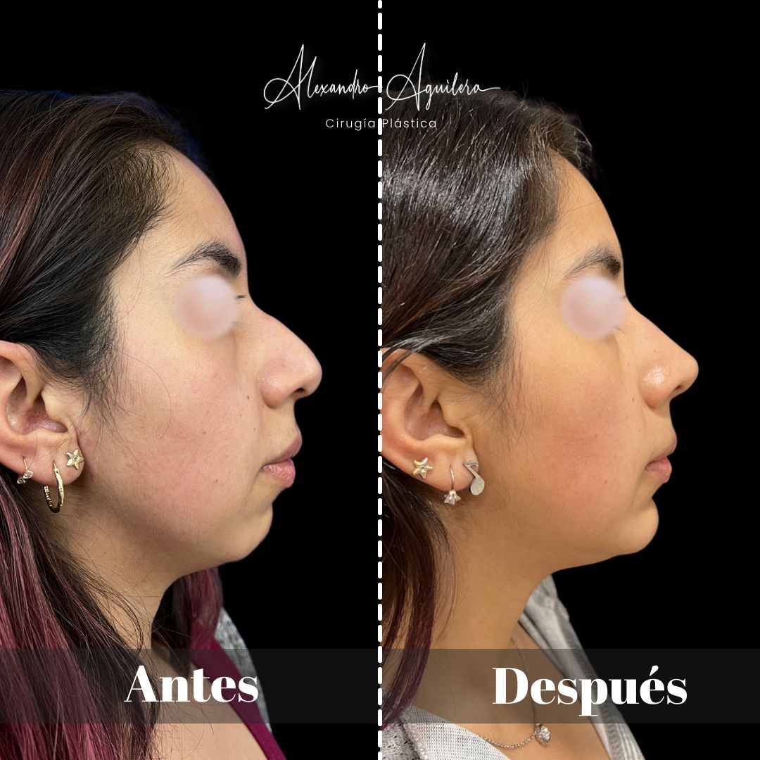 Alexandro Aguilera Salgado-34