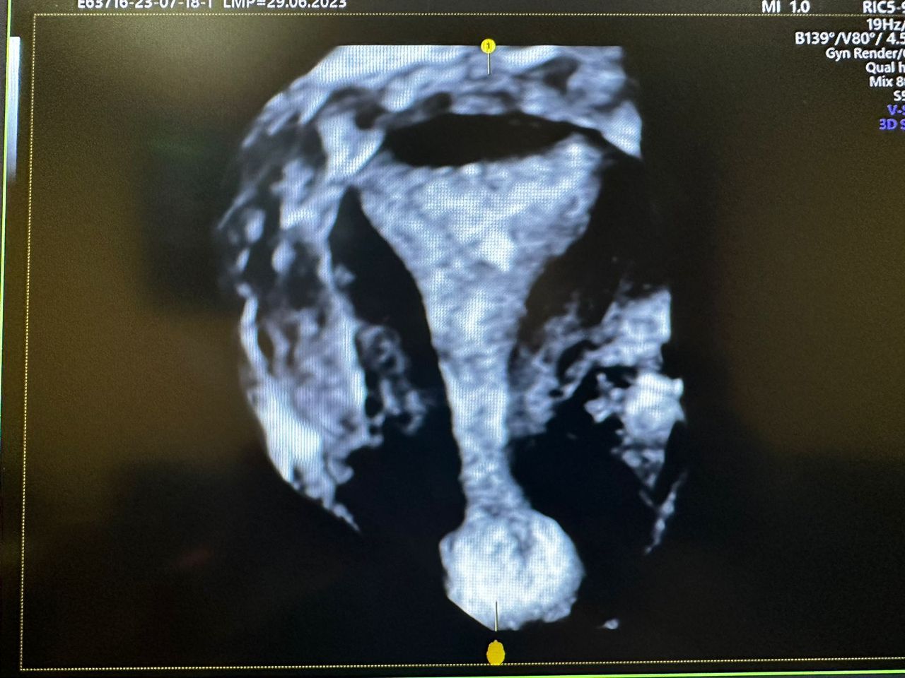 Jesus Armando Saucedo Torres-0