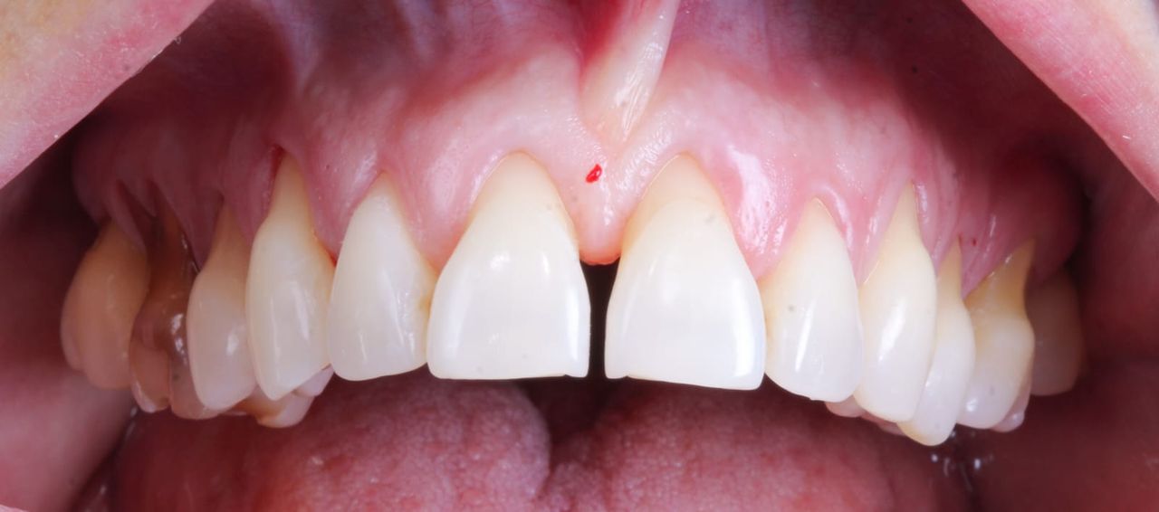 Hugo Enrique Aguilar Lamas-22