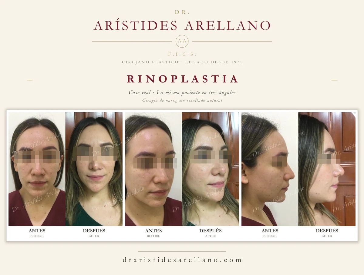 Arístides Arellano Huacuja-40