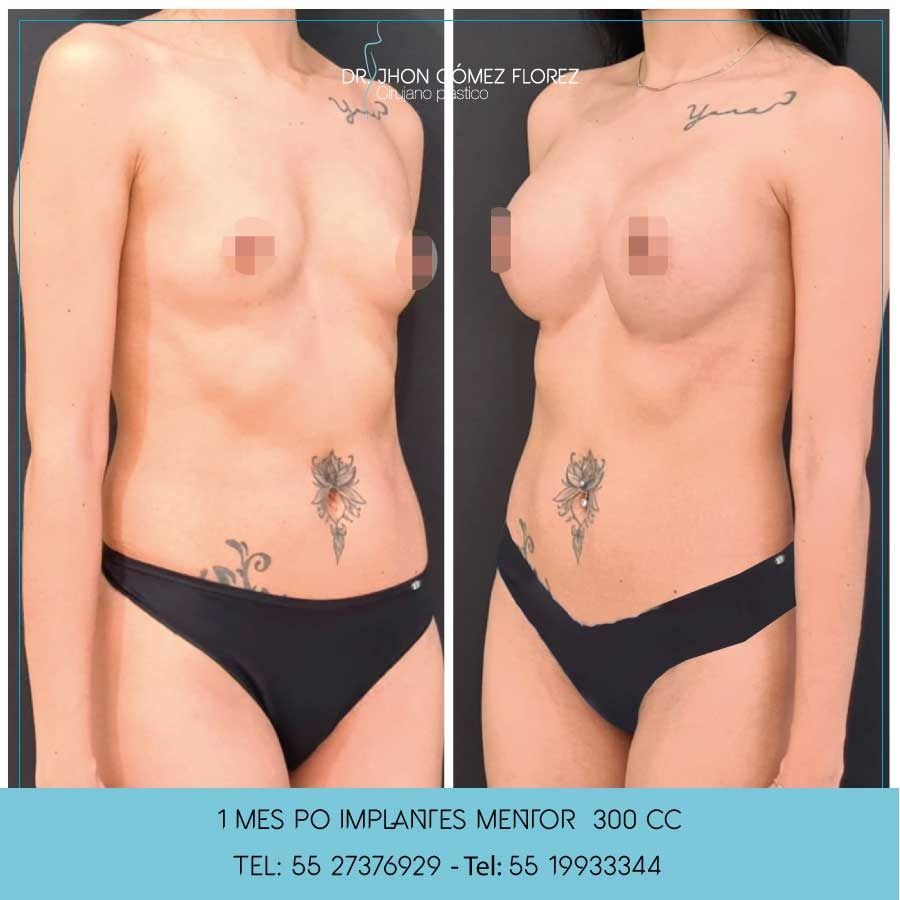 Jhon César Gómez Florez-28