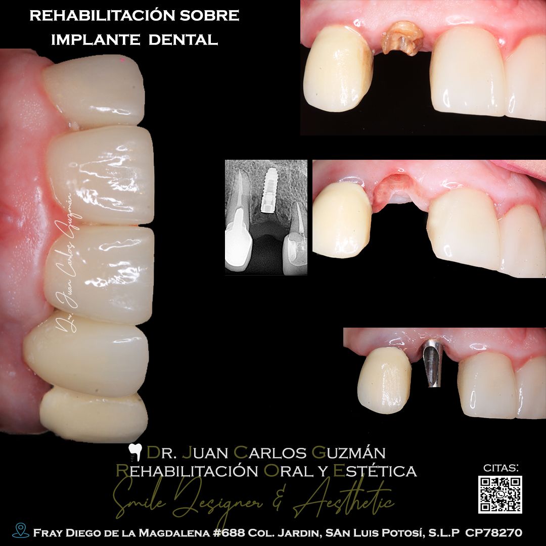 Juan Carlos Guzmán Castañeda-34