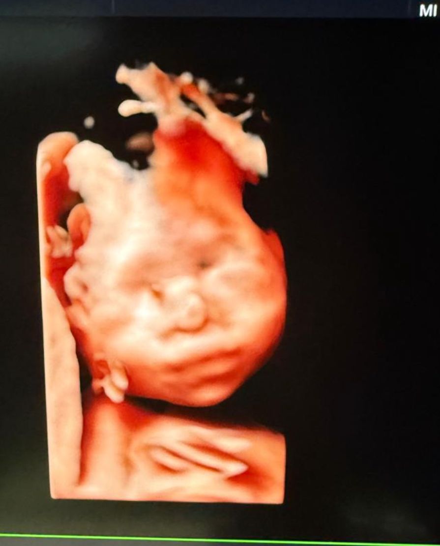 Carlos Ulises Romero Zarate-4