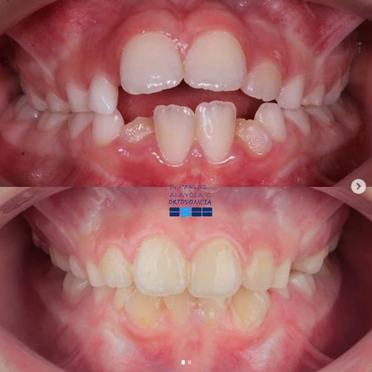 Carlos Humberto Alayola Cáceres-4