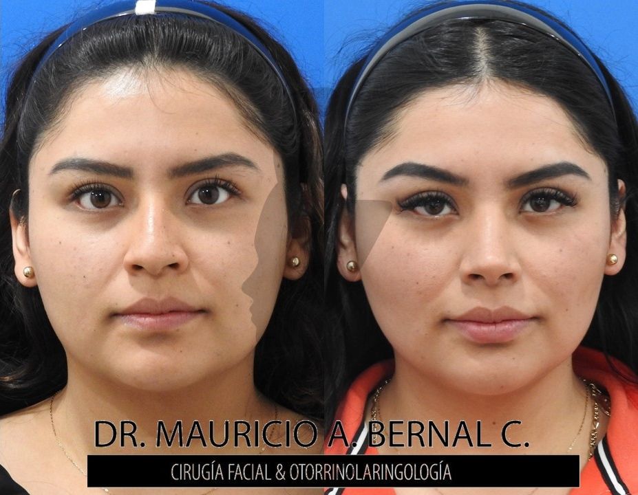 Mauricio Alejandro Bernal Carreon-15