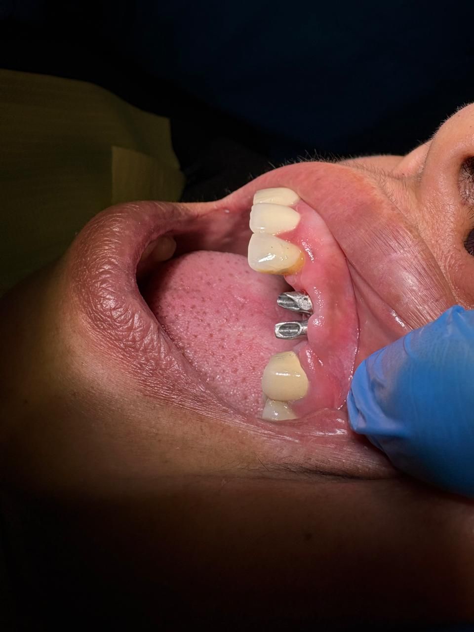 Arturo Romero Grande-39