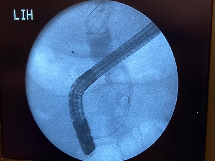 J. César Reyes Vásquez-3