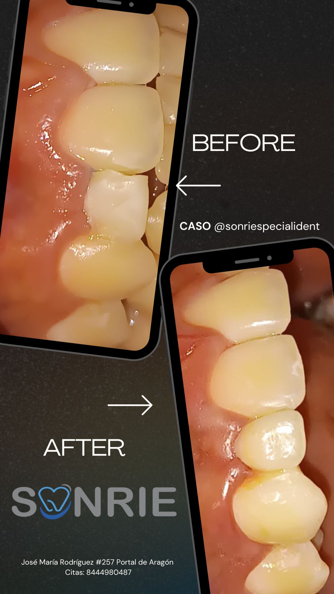 América Alejandra Coronado Hernández-8